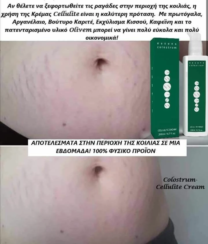 Vendora κρέμα με Colostrum